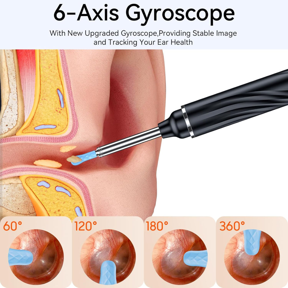 Ear Wax Removal Tool with Camera – 1080P HD Ear Cleaner with 6 LED Lights, 6 Ear Picks, Compatible with iOS & Android