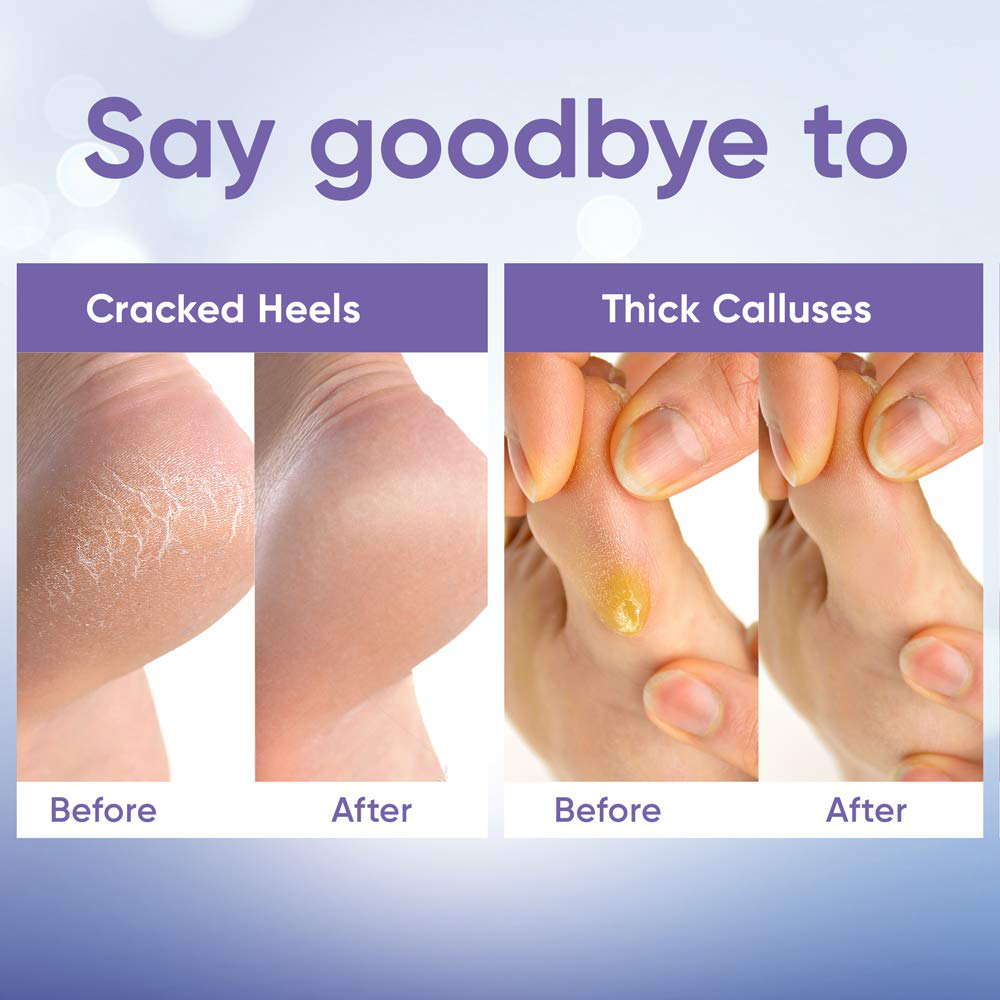 Foot Peel Mask (5 Pairs) - Foot Mask for Baby Feet and Remove Dead Skin - Baby Foot Peel Mask with Lavender and Aloe Vera Gel for Men and Women Feet Peeling Mask