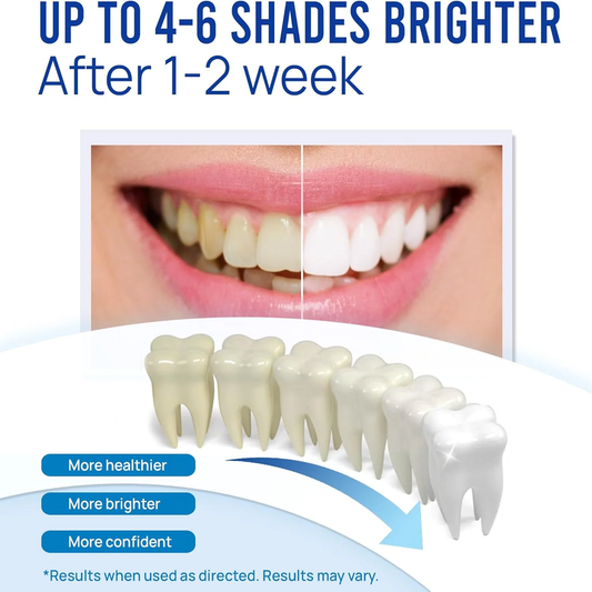 3 Pack Teeth Whitening Pens - 30+ Uses, Effective, Easy to Use, Mint Flavor