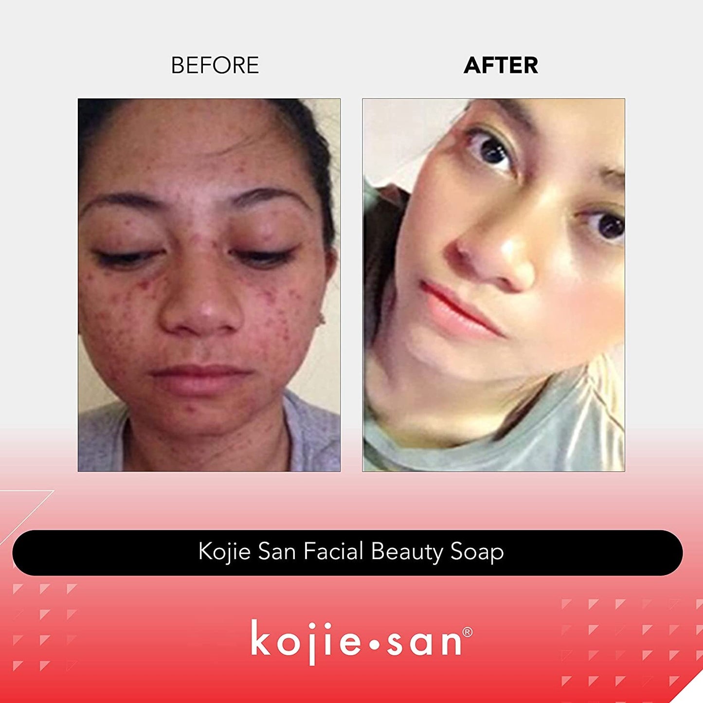  2 Bars Per Pack Facial Beauty Soap