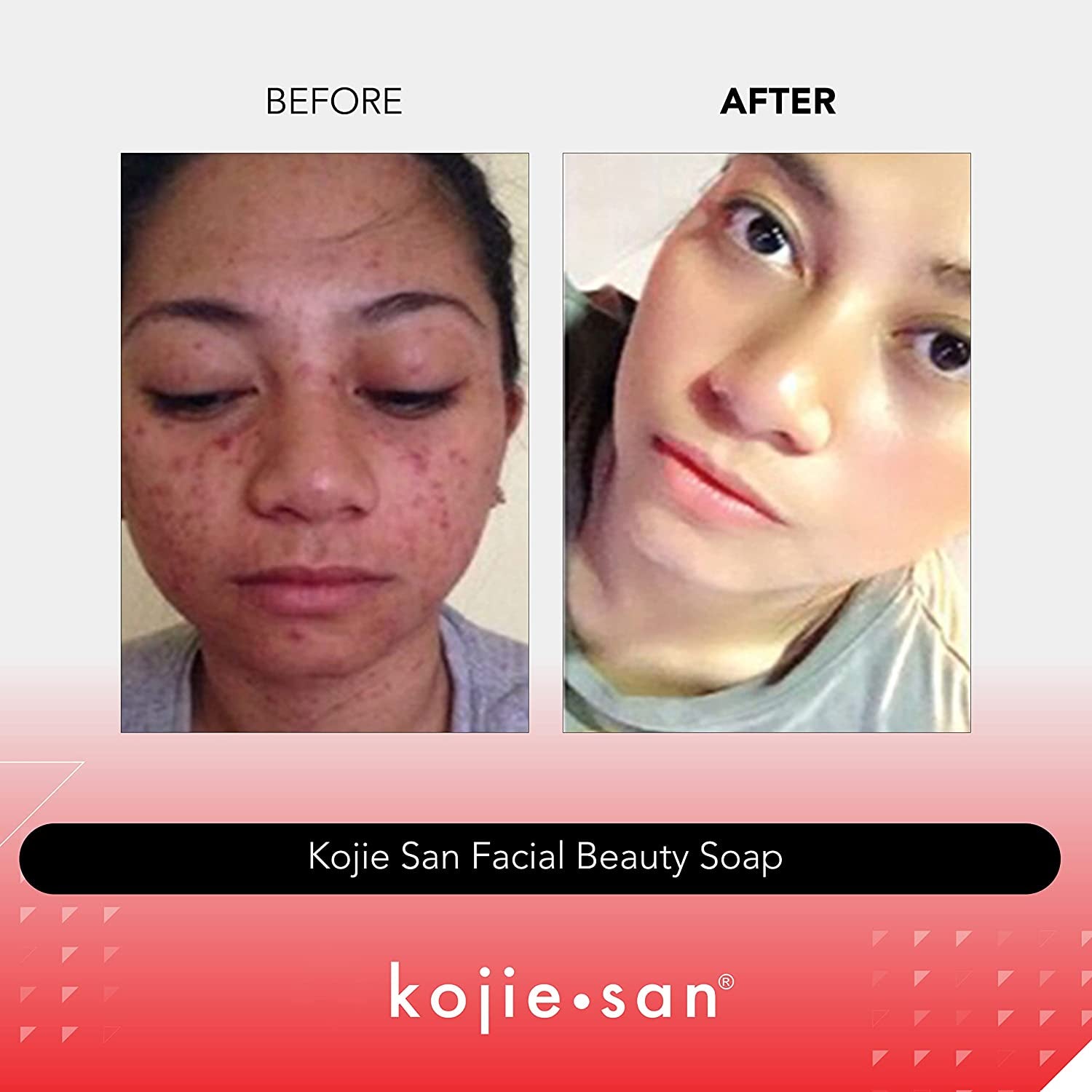  2 Bars Per Pack Facial Beauty Soap
