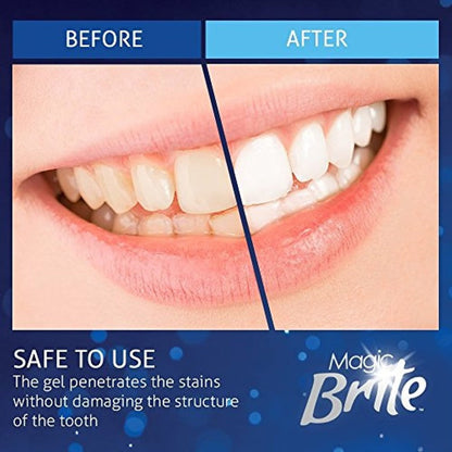Magic Brite At Home Complete Teeth Whitening Kit