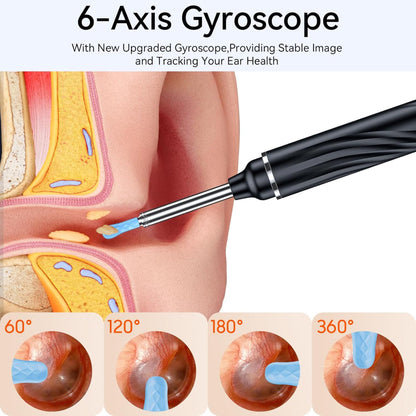 Ear Wax Removal Tool with Camera – 1080P HD Ear Cleaner with 6 LED Lights, 6 Ear Picks, Compatible with iOS & Android