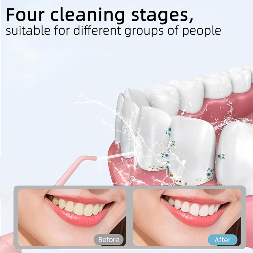 Cordless Water Dental Flosser – Portable Oral Irrigator – Teeth Cleaning Use – 320ml Rechargeable IPX7 Waterproof Design – Includes 5 Flossing Tips