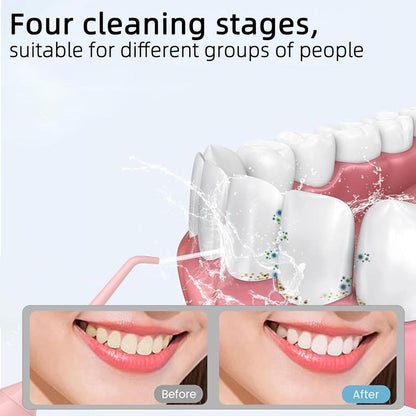 Cordless Water Dental Flosser – Portable Oral Irrigator – Teeth Cleaning Use – 320ml Rechargeable IPX7 Waterproof Design – Includes 5 Flossing Tips