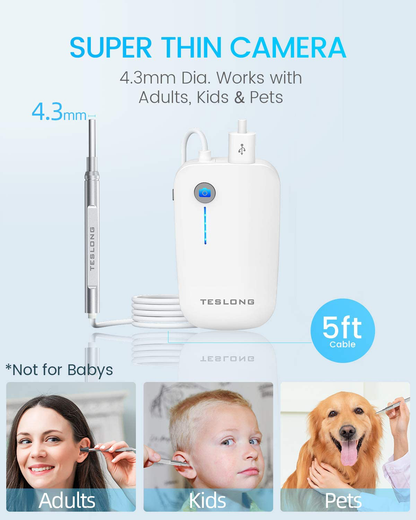Otoscope Ear Buddies Ear Cleaner, Teslong USB Ear Camera, Digital Otoscope Camera, HD Video Ear Scope, Ear Wax Removal Tool with LED Light for iPhone, Android Phone, Adult, Self, Child, Dogs for Home