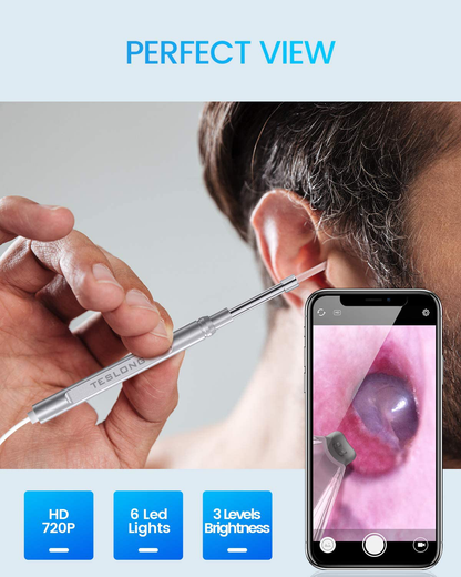 Otoscope Ear Buddies Ear Cleaner, Teslong USB Ear Camera, Digital Otoscope Camera, HD Video Ear Scope, Ear Wax Removal Tool with LED Light for iPhone, Android Phone, Adult, Self, Child, Dogs for Home