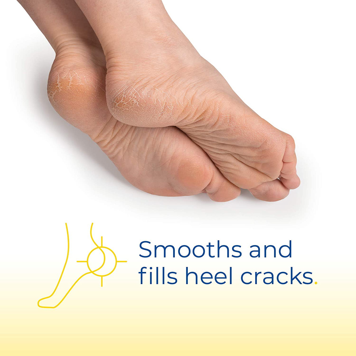 Dr. Scholl's Ultra Hydrating Foot Cream 3.5 oz, Lotion with 25% Urea for Dry Cracked Feet, Heals and Moisturizes for Healthy Feet