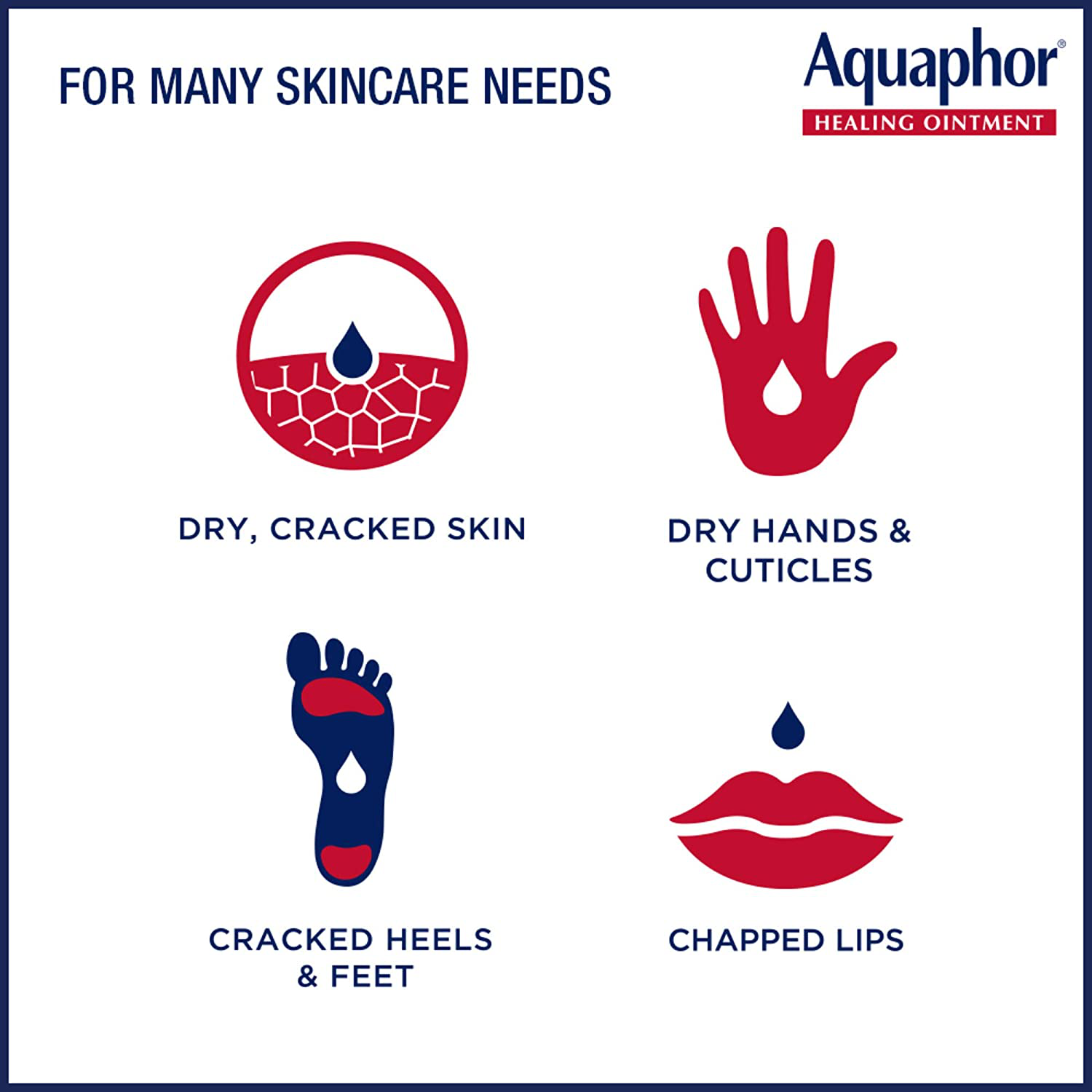 Aquaphor Healing Ointment Moisturizing Skin Protectant for Dry Cracked Hands Heels and Elbows Use After Hand Washing Oz Jar, bA, Fragrance Free, 14 Ounce