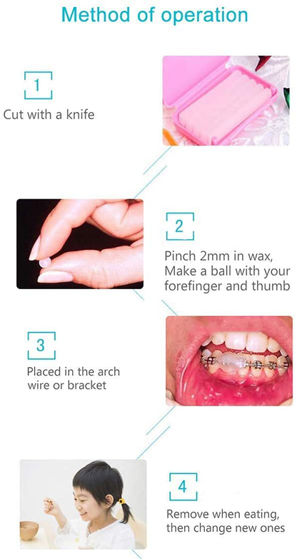 Chargenyang Dental Oral Care Orthodontics Wax with Fruit Smell for Brace Wearers Flavored Gum Protection (6 Boxes)