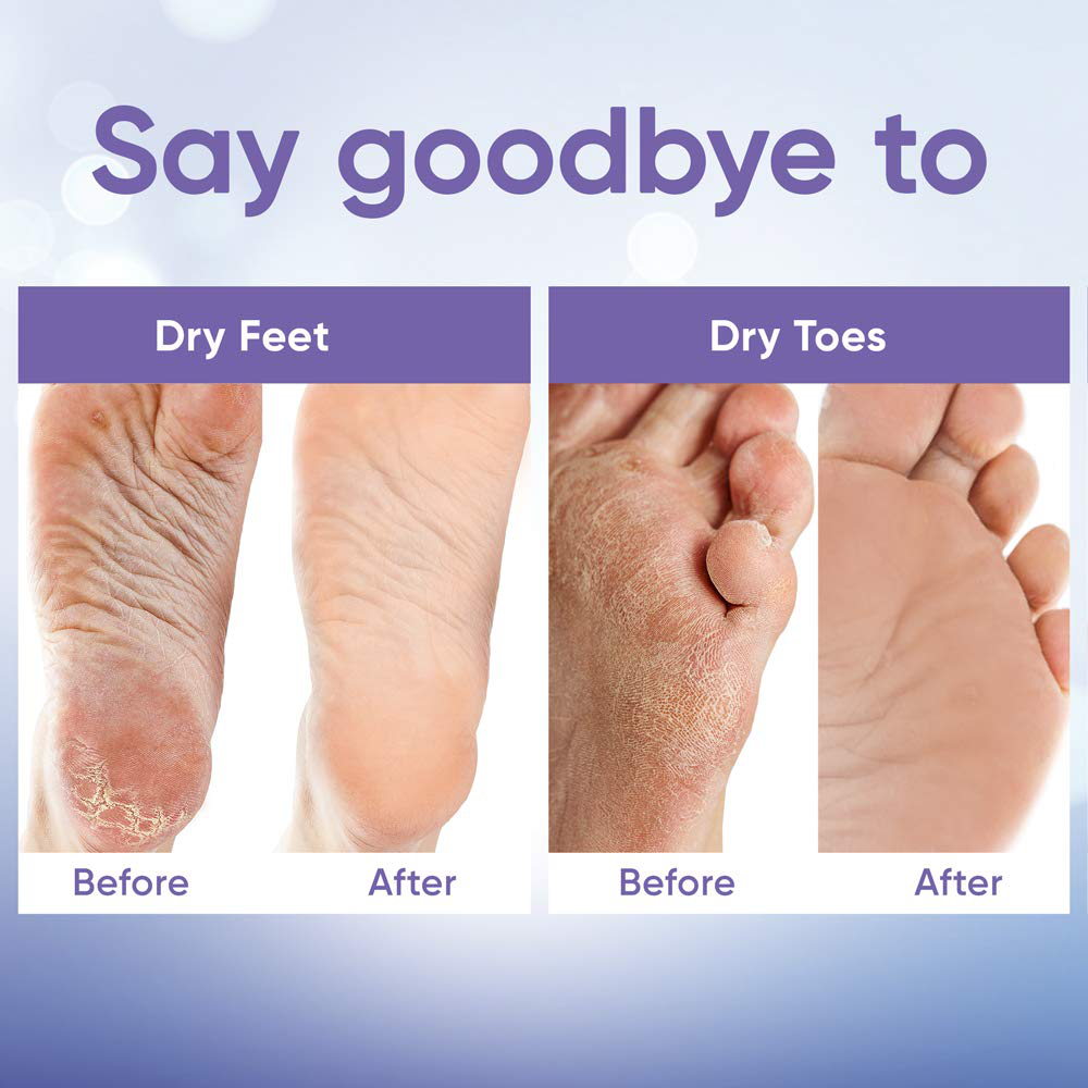 Foot Peel Mask (5 Pairs) - Foot Mask for Baby Feet and Remove Dead Skin - Baby Foot Peel Mask with Lavender and Aloe Vera Gel for Men and Women Feet Peeling Mask