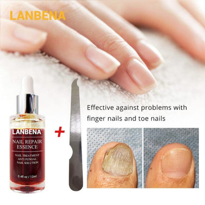 Nail Fungal Treatment Serum